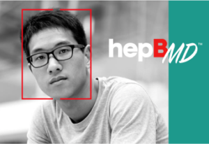 Black and white photo of a man with a serious expression outlined with a red box and the logo "HepBMD"